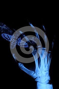 X-ray hand