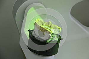 Scanning of casts on a 3D scanner for the manufacture of dentures