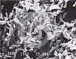 Scanning electron microscope photo of vibrio bacteria x5000