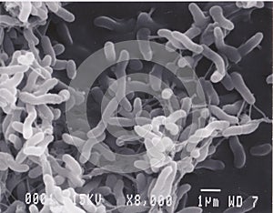 Scanning electron microscope photo of vibrio bacteria x8000