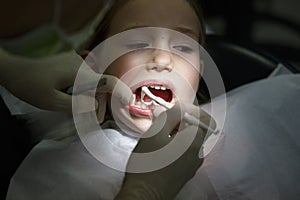 Scared little girl at the dentists office, in pain during a treatment