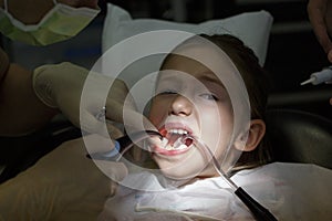 Scared little girl at the dentists office, in pain during a treatment