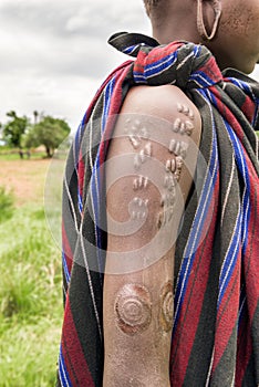 Scarification typical for the Mursi tribe in Ethiopia