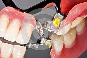 Dental prosthesis