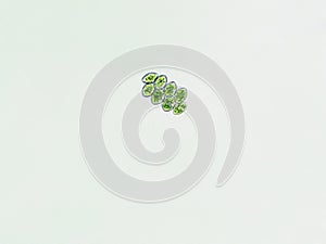 Scenedesmus arcuatus algae under microscopic view