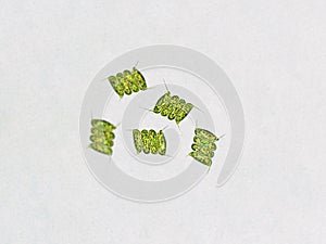 Scenedesmus sp. algae under microscopic view