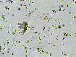 Scenedesmus sp. green algae under microscopic view