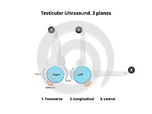 Schematic illustration of the testicular ultrasound scan photo