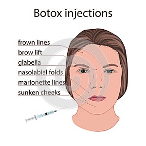 Scheme for beauty injections. Young woman face.