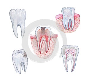 Schemes of  healthy tooth anatomy in a cross section and cavity photo