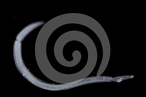 Schistosoma is a genus of trematodes, commonly known as blood flukes under the microscope .