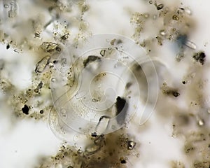 Schistosoma mature Parasite and ova in human urine specimen under microscope