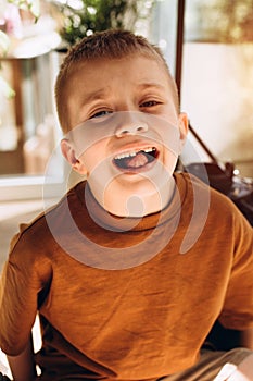 A school age boy shows the teeth that grow after the loss of milk teeth. Close-up portrait