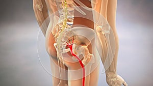 Sciatic Pinched Nerve 3D Render