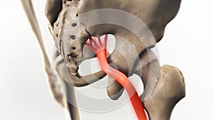 Sciatic Pinched Nerve Illustration