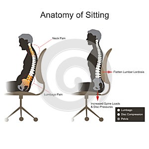 Sciatica. Health care info graphic .