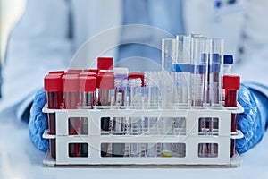 Science, blood and hands of doctor with test tube for biotech engineering, pathology and hematology research. Laboratory photo