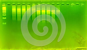 The science DNA analysis by PCR-RFLP of Apis mellifera by gel electrophoresis, PCR band of honey bees, DNA sequencing technique an