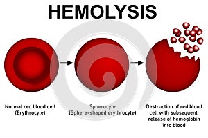 Scientific diagram and process of hemolysis