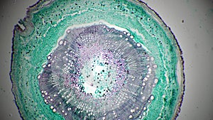 Scientific sample of stem of xylophyta dicotyledon in transversal section shown under microscope