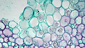 Scientific sample of stem of xylophyta dicotyledon in transversal section shown under microscope