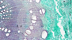 Scientific sample of stem of xylophyta dicotyledon in transversal section shown under microscope