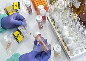 Scientist examines sample of coronavirus in laboratory
