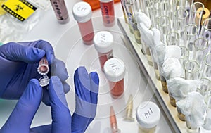 Scientist examines sample of coronavirus in laboratory