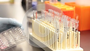 Scientist Filling Test Tubes in Lab