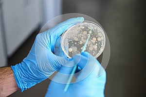 Scientist hands holding a petri dish with bacterial colonies analyzing microorganisms growth