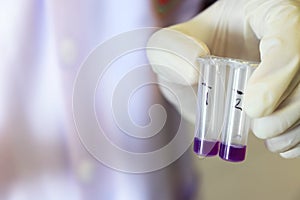 Scientist holding micro centrifuge tubes for testing anti-biotic in beef or meats by using test kit sample culture in purple.