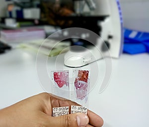 Scientist holding microscopic glass slide for the diagnosis of cytology department. Cytopathology, histopathology