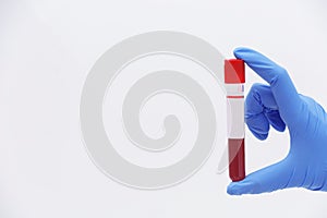 Scientist holding test tube with blood sample