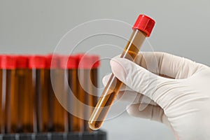 Scientist holding test tube with brown liquid against light background, closeup. Space for text