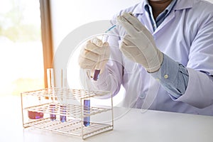 Scientist or medical in lab coat holding test tube with reagent