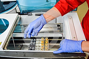 Scientist or medical in lab coat holding test tube with reagent, mixing reagents in glass flask, glassware containing chemical