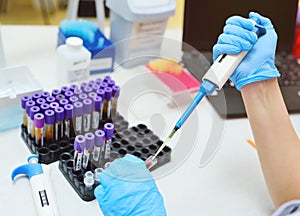 Scientist in a medical laboratory with a dispenser in his hands is doing an analysis