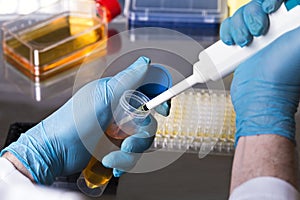 scientist pipetting a sample from a test tube for a clinical test