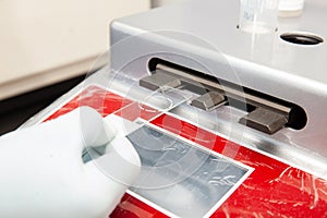 Scientist preparing microscope slides with liquid based cytology method for pap smear test. Cervical cancer concept. Medical