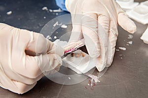 Scientist preparing paraffin blocks containing biopsy tissue for sectioning. Pathology laboratory. Cancer diagnosis photo