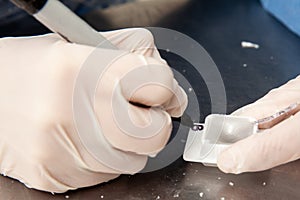 Scientist preparing paraffin blocks containing biopsy tissue for sectioning. Pathology laboratory. Cancer diagnosis photo
