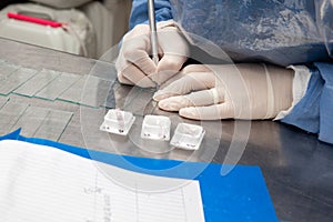 Scientist preparing paraffin blocks containing biopsy tissue for sectioning. Pathology laboratory. Cancer diagnosis