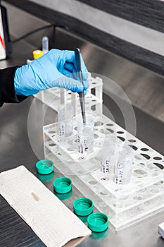 Scientist preparing slides for karyotype and fluorescence in situ hybridization - FISH in the laboratory. Acute lymphocytic