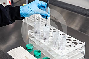 Scientist preparing slides for karyotype and fluorescence in situ hybridization - FISH in the laboratory. Acute lymphocytic