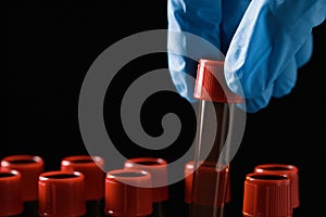 Scientist putting test tube with brown liquid into stand against black background, closeup