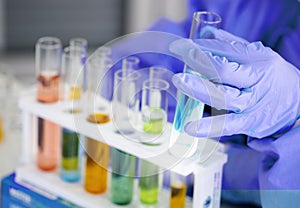 The scientist`s hand holds a beaker of chemicals in the lab to prepare specimens to test photo