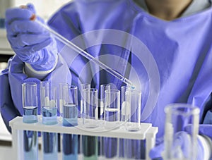 The scientist`s hand holds a beaker of chemicals in the lab to prepare specimens to test