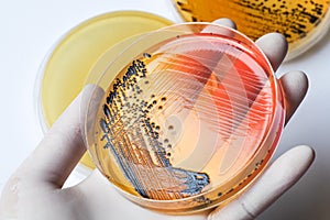 Scientist's hand in latex glove holding the bacteria growing pet