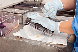 Scientist staining microscope slides for cytology studies in the laboratory
