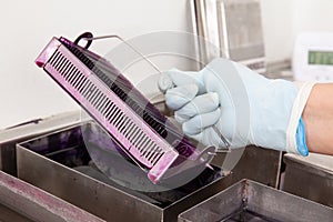 Scientist staining microscope slides for cytology studies in the laboratory photo